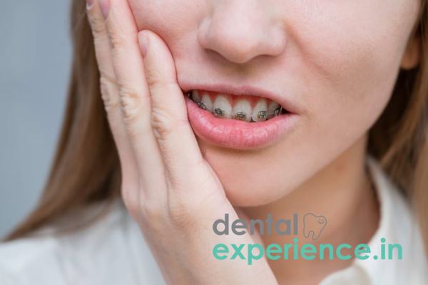 10 Easy Ways to Remove or Avoid Pain During Orthodontic Treatment